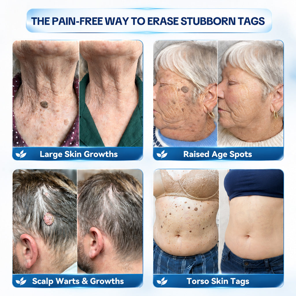 Dyceco® ☑️ | 7-𝐃𝐚𝐲 𝐒𝐤𝐢𝐧 𝐓𝐚𝐠 & 𝐒𝐩𝐨𝐭 𝐄𝐫𝐚𝐬𝐞𝐫 𝐂𝐫𝐞𝐚𝐦 (Zero Pain, Zero 𝐒𝐜𝐚𝐫𝐬 Formula)