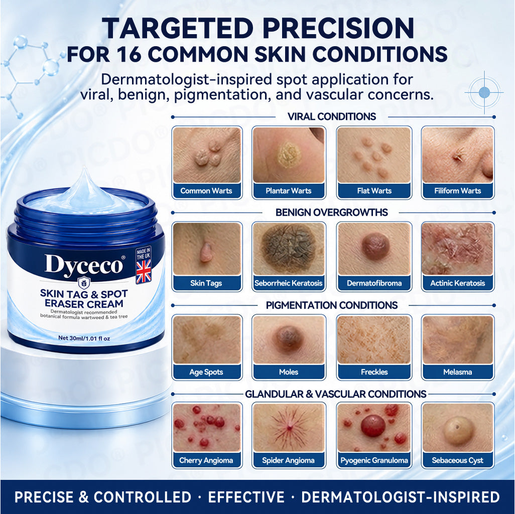 Dyceco® ☑️ | 7-𝐃𝐚𝐲 𝐒𝐤𝐢𝐧 𝐓𝐚𝐠 & 𝐒𝐩𝐨𝐭 𝐄𝐫𝐚𝐬𝐞𝐫 𝐂𝐫𝐞𝐚𝐦 (Zero Pain, Zero 𝐒𝐜𝐚𝐫𝐬 Formula)